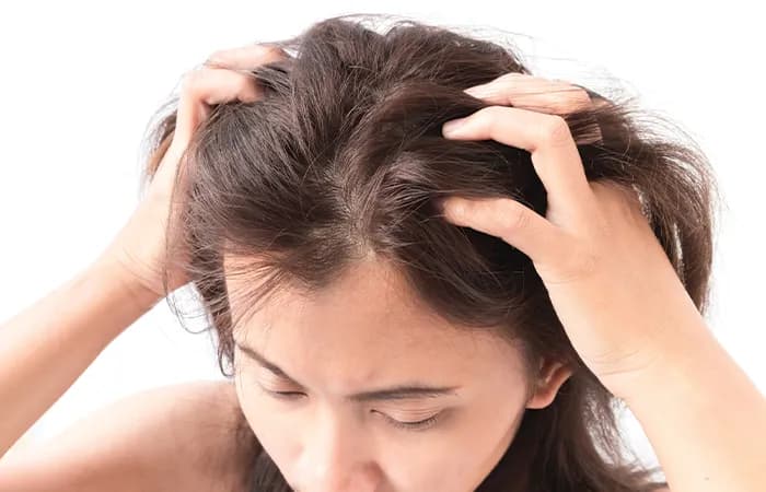 7 عامل شایع خارش پوست سر و راه‌حل‌های قطعی برای درمان سریع