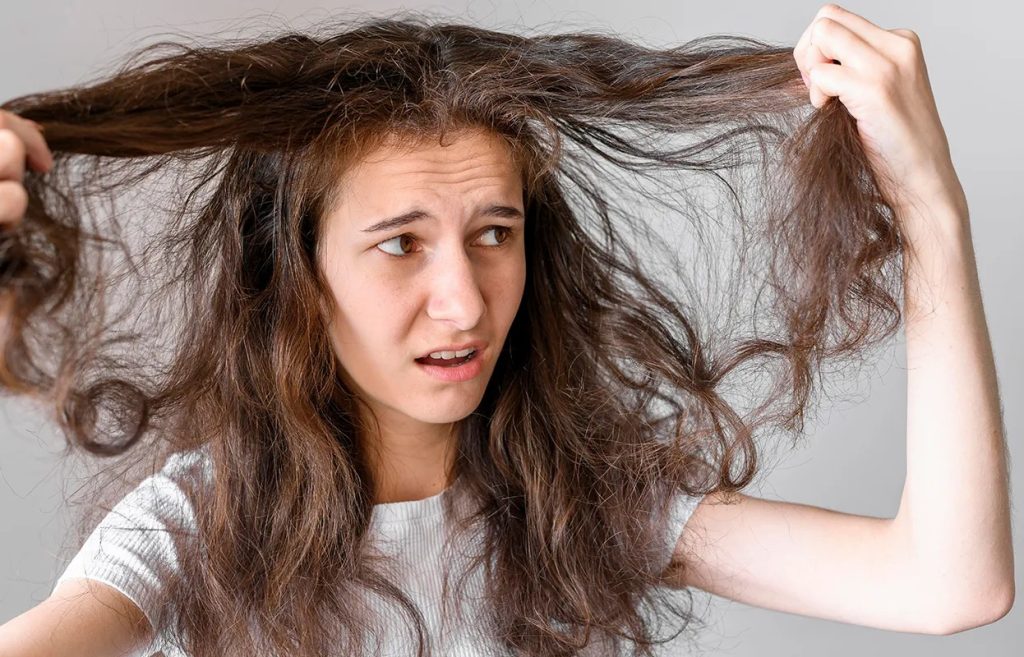 4 راه حل قطعی خانگی از بین بردن موخوره برای موهای بلند